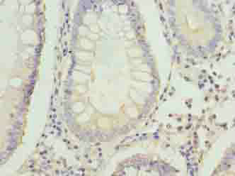 FAM3B Polyclonal Antibody