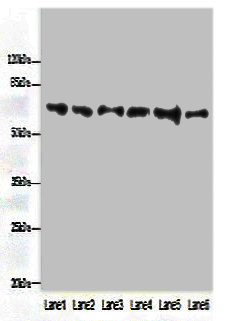 FBXO24 Polyclonal Antibody