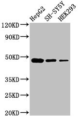 FDFT1 Polyclonal Antibody