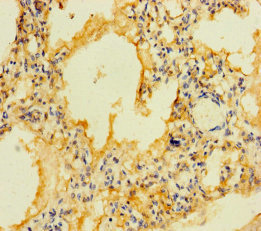 Immunohistochemistry of paraffin-embedded human lung tissue using FFAR2 Polyclonal Antibody at dilution of 1:100
