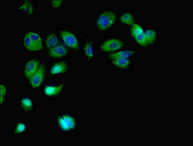 Immunofluorescent analysis of MCF-7 cells using FFAR2 Polyclonal Antibody at a dilution of 1:100 and Alexa Fluor 488-congugated AffiniPure Goat Anti-Rabbit IgG (H+L)