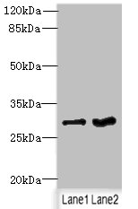 FGFR1OP2 Polyclonal Antibody