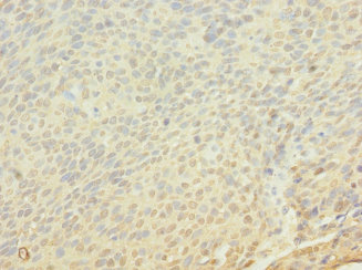 FRS3 Polyclonal Antibody