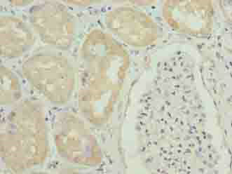 GGTLC1 Polyclonal Antibody