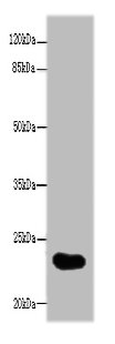 GGTLC2 Polyclonal Antibody