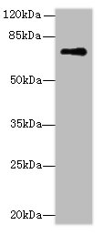 GLS Polyclonal Antibody