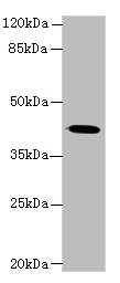 GNA14 Polyclonal Antibody