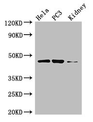 GSK3B Polyclonal Antibody (100 µl)