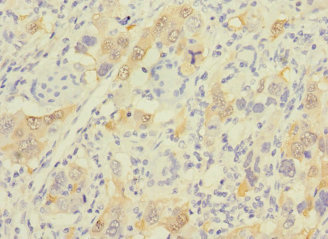 GSTA1 Polyclonal Antibody