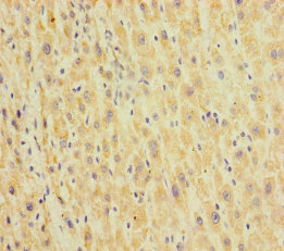 HEPACAM2 Polyclonal Antibody