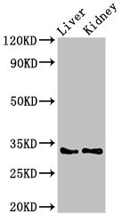 HEXIM2 Polyclonal Antibody