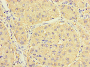 HRSP12 Polyclonal Antibody