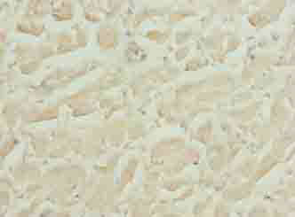 HS3ST1 Polyclonal Antibody