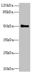 IFI44 Polyclonal Antibody