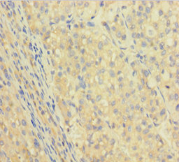 IGHG1 Polyclonal Antibody