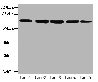 ILVBL Polyclonal Antibody