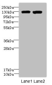 ITGAL Polyclonal Antibody