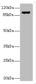 ITGB1 Polyclonal Antibody