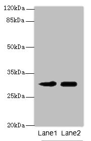 ITM2A Polyclonal Antibody