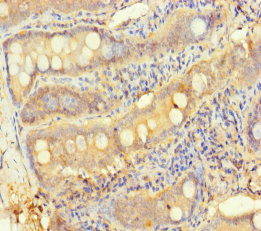 TESPA1 Polyclonal Antibody