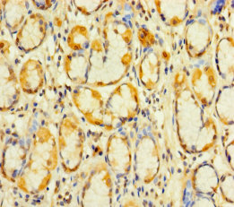 KIAA1324L Polyclonal Antibody