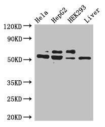 KRT81 Polyclonal Antibody
