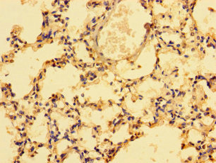 LAIR1 Polyclonal Antibody