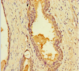 LIMS3 Polyclonal Antibody