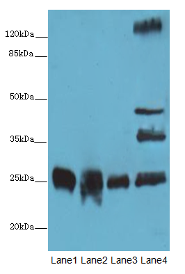 LIN7A Polyclonal Antibody