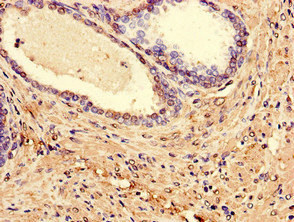 LPXN Polyclonal Antibody