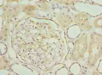 LRRN2 Polyclonal Antibody