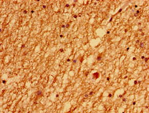 LSM1 Polyclonal Antibody