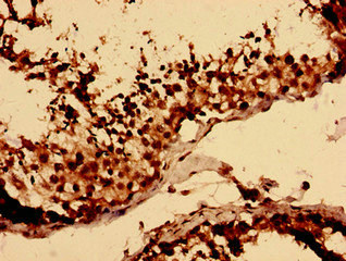 LY6H Polyclonal Antibody