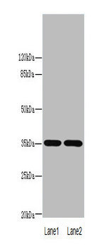 LYPD3 Polyclonal Antibody