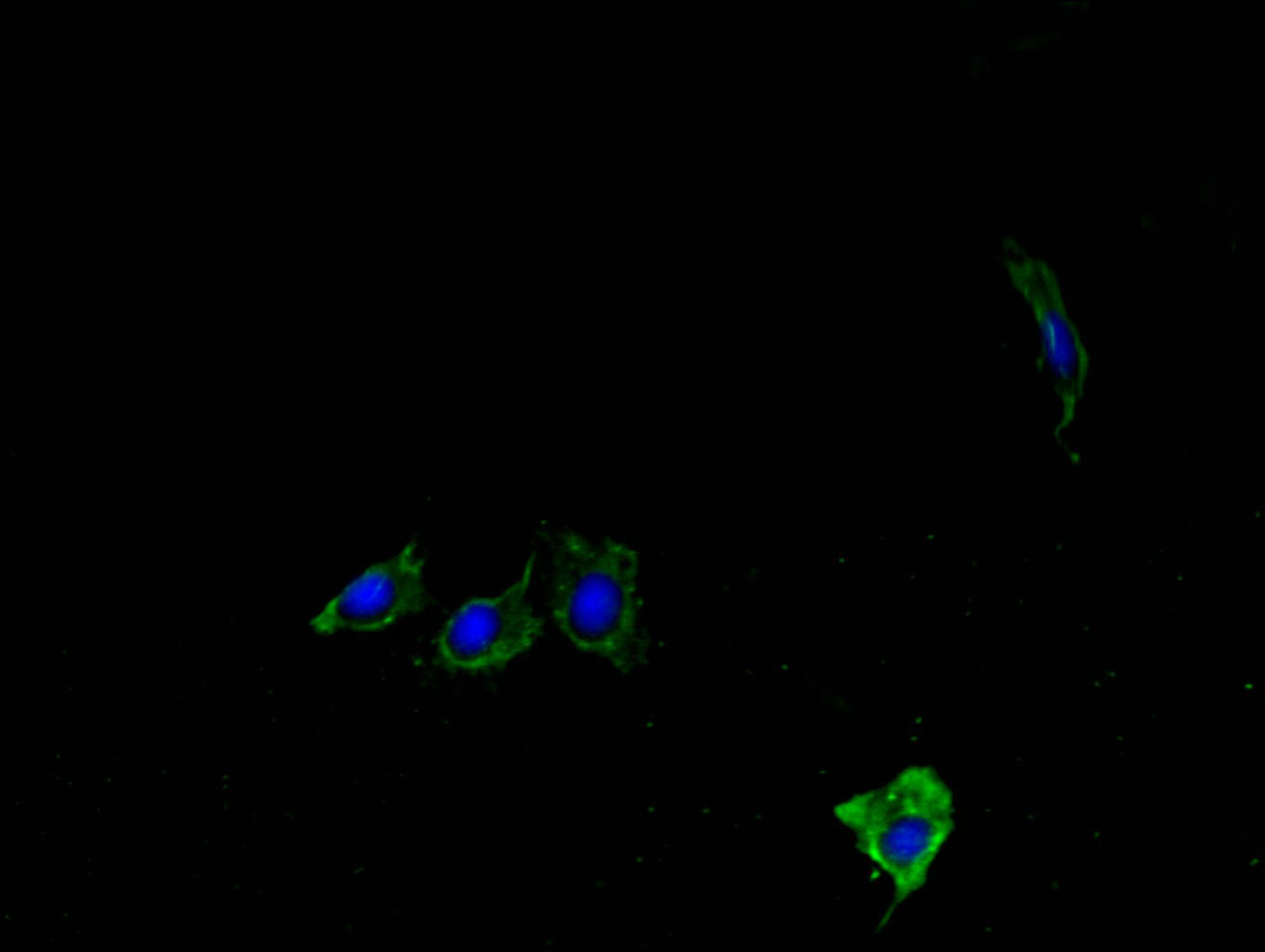 Lypla1 Polyclonal Antibody