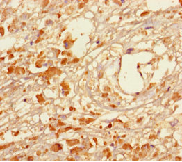 MAGEA5 Polyclonal Antibody