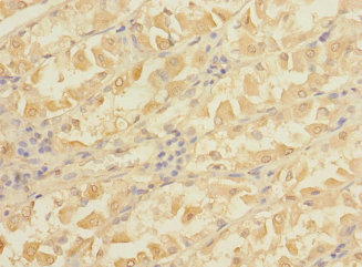 MAP3K7 Polyclonal Antibody