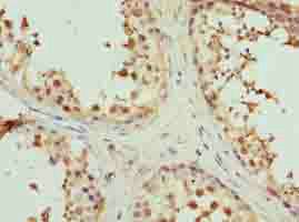 MAT2A Polyclonal Antibody