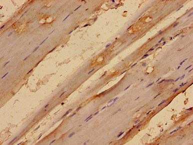 MED24 Polyclonal Antibody