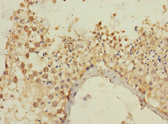 MLLT10 Polyclonal Antibody