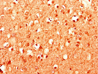 MPDU1 Polyclonal Antibody
