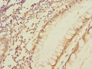 MPZL2 Polyclonal Antibody