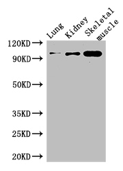 MSH4 Polyclonal Antibody