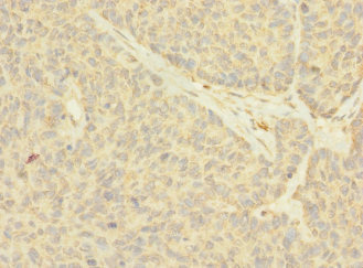 NANOS2 Polyclonal Antibody