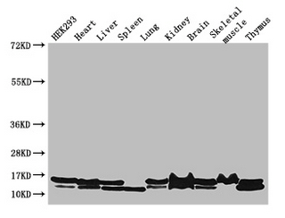 NDUFB6 Polyclonal Antibody