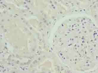 NOX4 Polyclonal Antibody