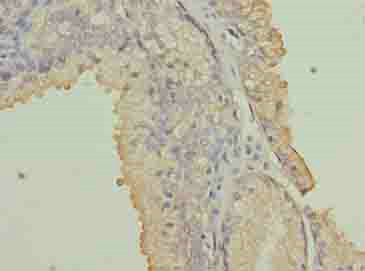 NRARP Polyclonal Antibody (20 µl)