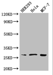 NUDT21 Polyclonal Antibody