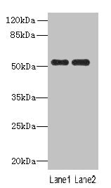 PAH Polyclonal Antibody