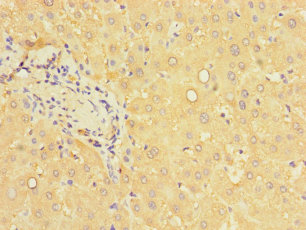 PCBD1 Polyclonal Antibody